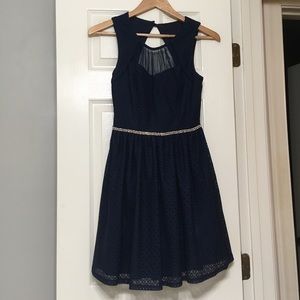 Short Navy Lace Prom Dress 💕